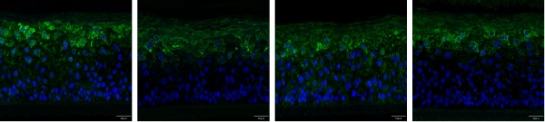 Promotion of Caspase-14 Expression