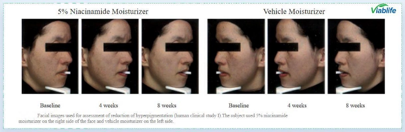 Nicotinamid zur Aufhellung der Haut Nicotinamide for Skin Brightening